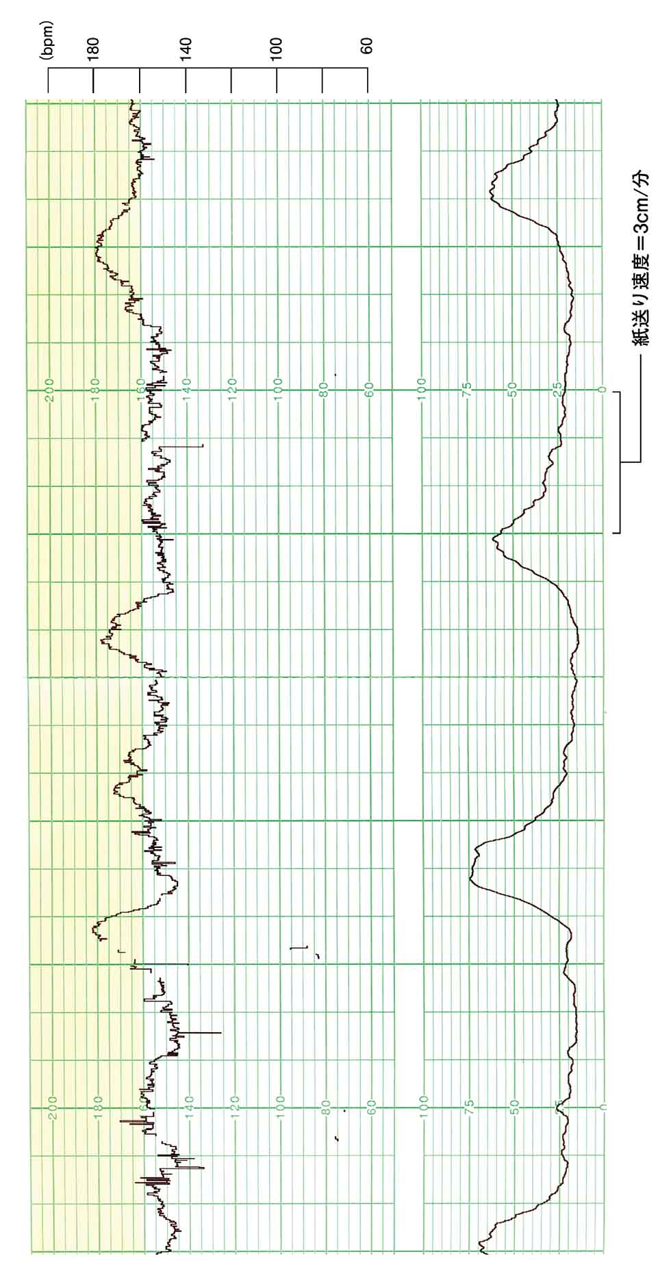 3cm 子宮口